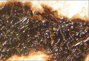 Fig_11